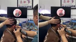 Küçük çocuğun kulağından çıkana, doktorlar bile şaştı kaldı