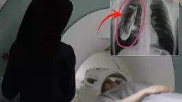 Hastaya Göğsünde canlı böcek var dendi, gerçek çok başka çıktı
