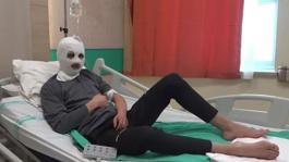 Çakmak gazı faciası! Bomba gibi patladı: Ben yandım, başkası yanmasın