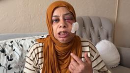 Akraba ziyaretine giderken bu hale geldi