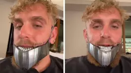 Bir maçla 92 milyon dolar kazanmıştı! Aylardır pipetle beslenen Jake Paulün başı dertten kurtulmuyor