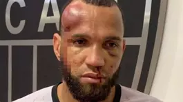 23 kırmızı kartın çıktığı futbol savaşında kaleci tanınmayacak hale geldi