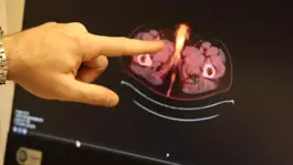 Tıp literatürüne giren son isim Diyarbakırdan! Penisi alındı