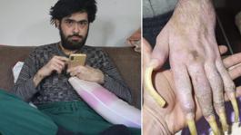 Türkiyenin konuştuğu Barışın son hali! 25 yaşını kutladı, türkü bile söyledi