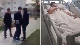 Yaşıtını bıçakla ağır yaralayan çocuk saldırı anını da kayda aldırdı