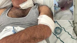 Severek beslediği hayvan bu hale getirdi