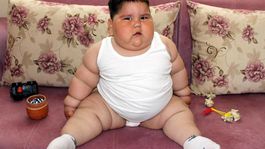 5 yaşındayken 90 kiloydu! Minik Yağızın 6 yıl sonraki halini görenler inanamıyor