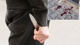 16 yaşındaki çocuk sokakta bacağından bıçaklandı