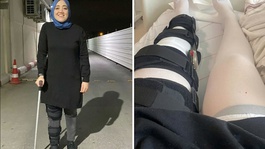 Yanlış bacak ameliyatı: 2 yıl sonra adli tıp raporuyla kanıtlandı