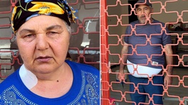26 yıl önce boşandığı eşi tarafından bıçaklanan kadın: Yüzünü unutmuşum, tanıyamadım