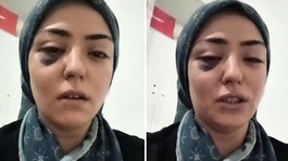 Bir annenin yardım çığlığı: Ben yaşıyorken hakkımı savunun