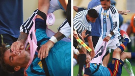 Yenilgiyi hazmedemeyip futbolculara saldıran Paredese dev ceza