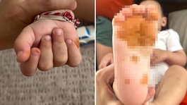 Olay Türkiyede yaşandı! Sabah uyandığında çocuğunun eline ayağına bakan anne şoke oldu