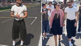 Hakan Çalhanoğlunu görenler gözlerine inanamadı! Bu ne hal Hakan?