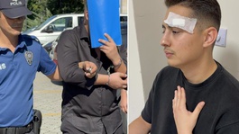 Hastanede akılalmaz saldırı! Sağlık çalışanının omzu kırıldı