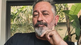Cem Yılmaz, baston kullanmaya başladı