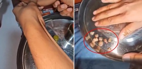 “Böbrek taşı döküyor” dendi Yaptığı numara kısa sürede anlaşıldı