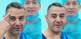 Gençleşmek için Vietnam’ın yolunu tuttu Son hali şaşkına çevirdi