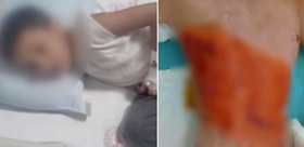12 yaşındaki çocuğu diri diri yaktılar Sonrası daha da korkunç