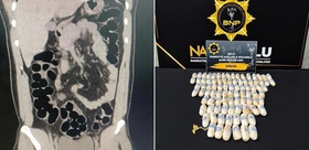 Bolu’da narkotik ekiplerinin durdurduğu araçtaki İranlı şüphelinin midesinde 943 gram eroin bulundu