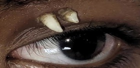 Tıp tarihinde bir ilk Muayene eden doktorlar bile inanamadı