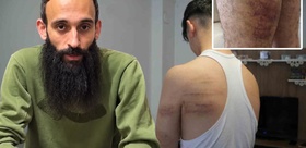15 yaşındaki çırağa işkencede yeni gelişme Yeniden gözaltına alınan cani berber tutuklandı