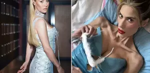 Nihal Candan'ın ardından İrem Derici ve Derya Uluğ'dan sarsansıcı Anoreksiya itirafı