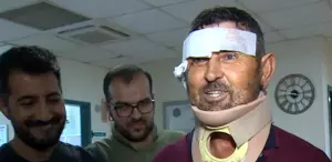 Antalya'da Aslan Saldırısı: Çiftçi Taburcu Oldu