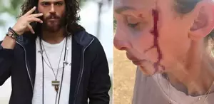 Can Yaman'ın sevgilisi Sara Bluma şiddet gördüğünü açıkladı