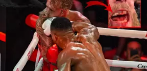 6. rauntta kabusu yaşamıştı İşte çenesi kırılan Jake Paul’un son hali