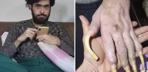 Türkiye’nin konuştuğu Barış’ın yeni işini ve son halini görenler şaşıp kalıyor