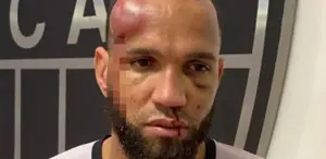 23 kırmızı kartın çıktığı futbol savaşında kaleci tanınmayacak hale geldi