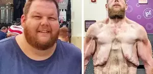 163 kilo verdi ama çilesi bitmedi