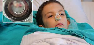 Burun tıkanıklığı şikayetiyle hastaneye gitti, ağzından dev bir polip çıkartıldı