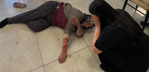Saldırgan köpek kadının kolunu kopardı