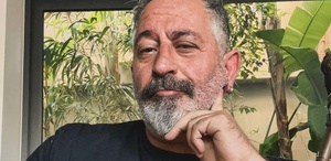 Cem Yılmaz, baston kullanmaya başladı