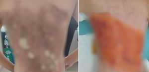 12 yaşındaki çocuğu diri diri yaktılar Sonrası daha da korkunç