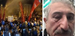 Bursa’da ’İmamoğlu’ protestosu: CHP İl Başkanı gözünden yaralandı