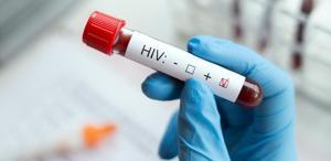HIV tedavisinde devrim niteliğinde adım