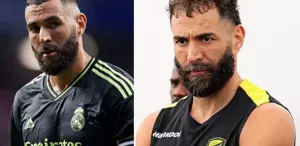 Benzema’nın son hali şaşırttı Arabistan’da 10 yaş yaşlandı