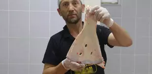 Selçuklu’dan kalan gelenek asırlardır sürdürülüyor, büyü yapılmasın diye kürek kemikleri kırılıyor