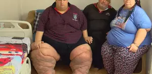 Sadece iki yılda bu hale geldi Evden bile çıkamıyor