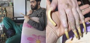Telefon bağımlısı genç: Elimde olsa tuvalete de gitmem, yemek de yemem