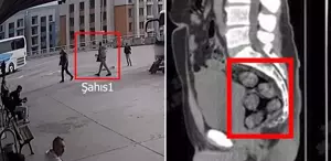 Tomografideki görüntü şoke etti Zehir tacirleri yakayı böyle ele verdi