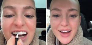 Dişlerini beyazlatmak için yaptığı akılalmaz