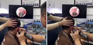 Küçük çocuğun kulağından çıkana, doktorlar bile şaştı kaldı