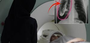 Hastaya ’’Göğsünde canlı böcek var’’ dendi, gerçek çok başka çıktı