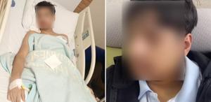 “Sıramdan kalkar mısın“ diyen öğrencinin çenesini kırdılar