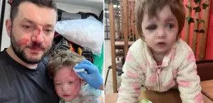 Komşuların gürültü kavgasında 14 aylık bebeğin kafatası çatladı