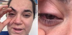 Bulaşık makinesi tableti kadının gözüne patladı, kör olma korkusu yaşadı